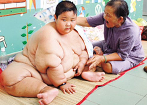 Bé trai 13 tuổi nặng 100 kg Bé trai 13 tuổi nặng 100 kg